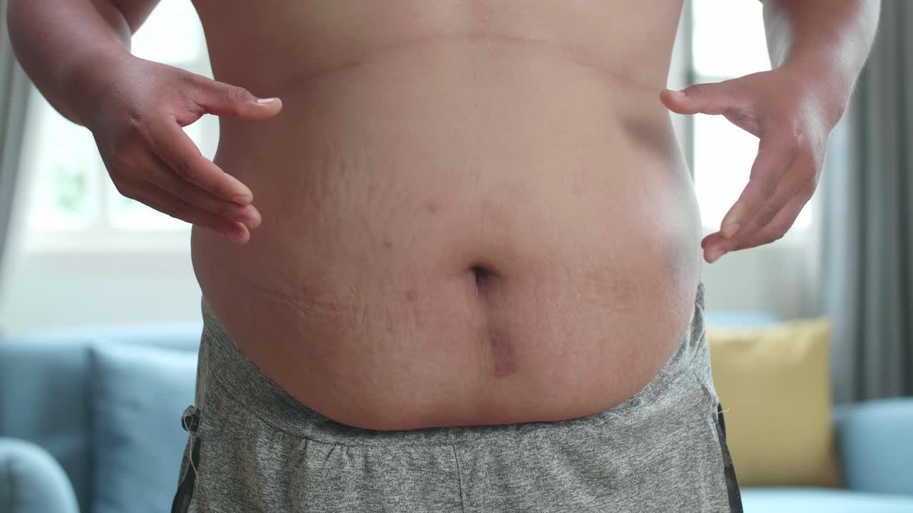 Primo piano di un uomo in sovrappeso che pizzica l'eccesso di grasso intorno alla vita.