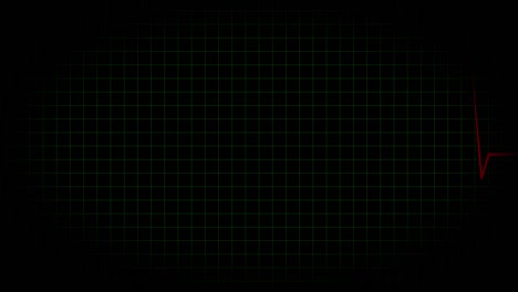 electrocardiograma osciloscopio forma de onda animación gráficos de movimiento