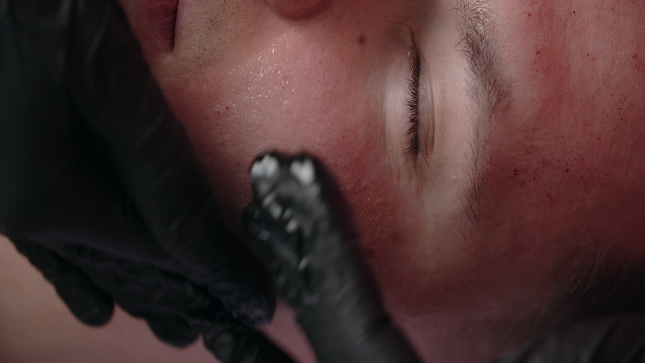 진행 중인 얼굴 치료