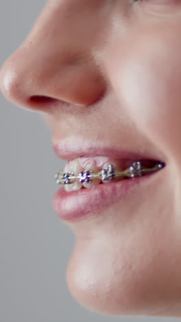 Woman with Braces