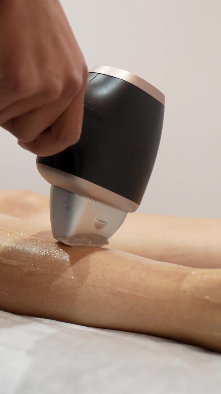 Tratamento Profissional de Depilação a Laser na Perna