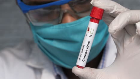 análisis de muestras de sangre de coronavirus
