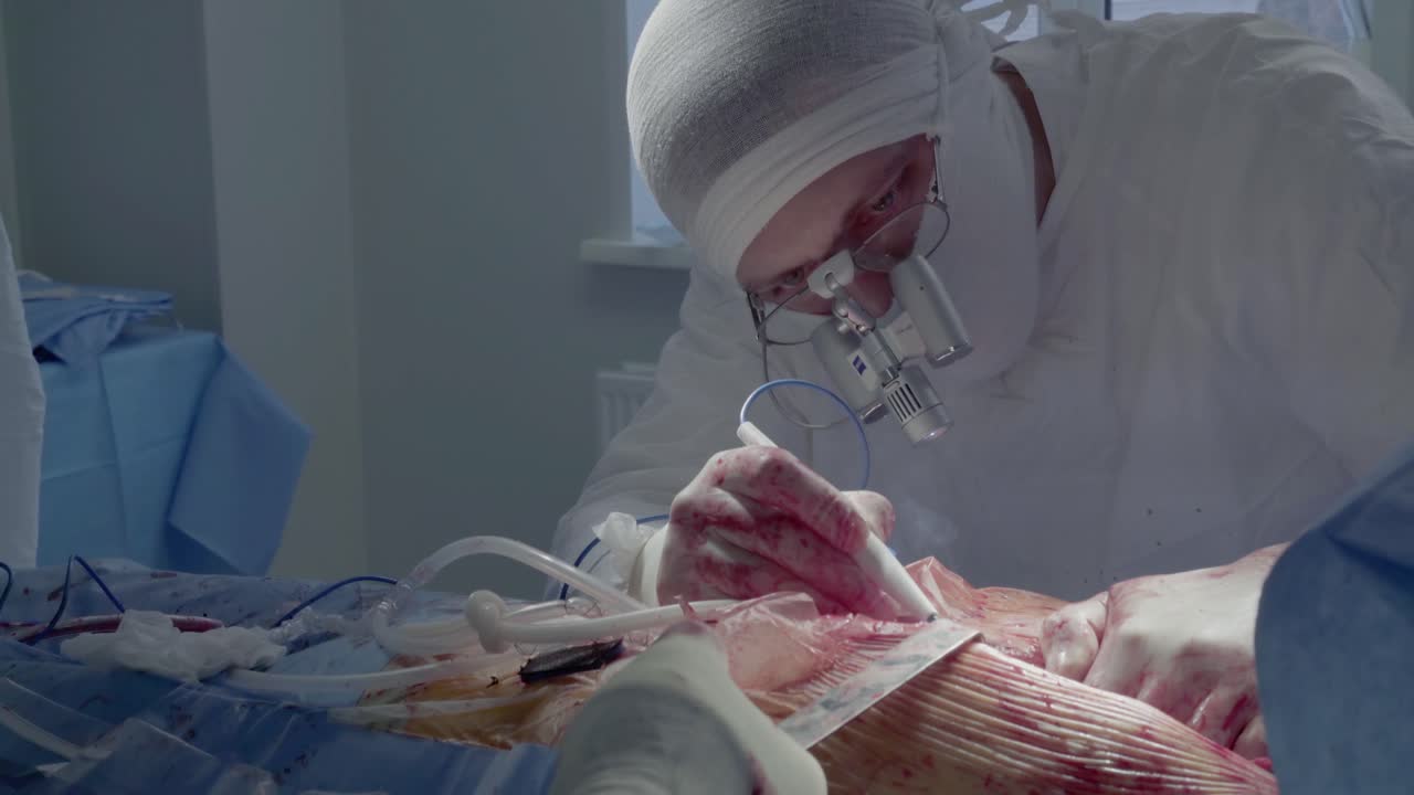 Cardiosurgeon performs the incision with the aid of a coagulator 2