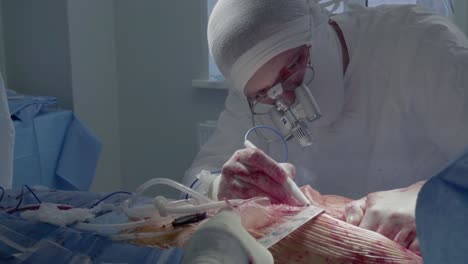 cardiosurgeon performs the incision with the aid of a coagulator 2