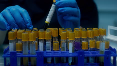 recogida de muestras de sangre en un laboratorio