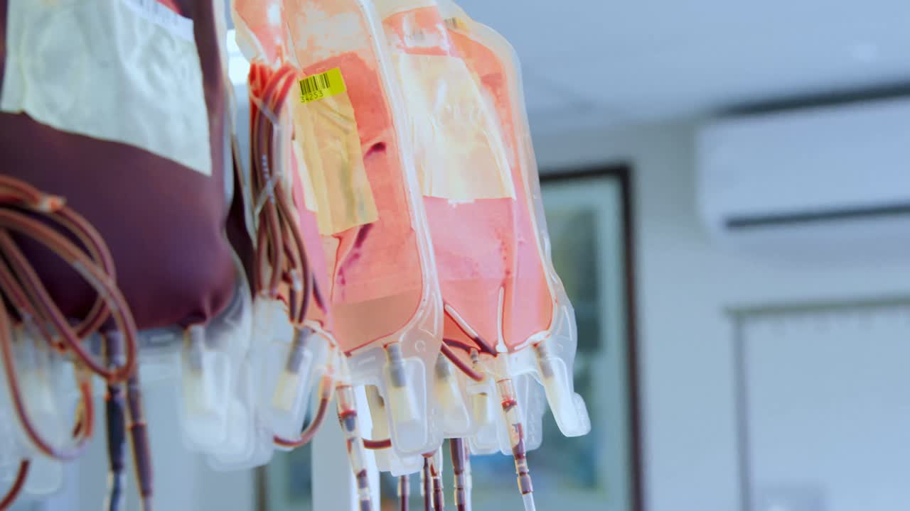 Sacche di sangue appese a un'asta portaflebo 4k