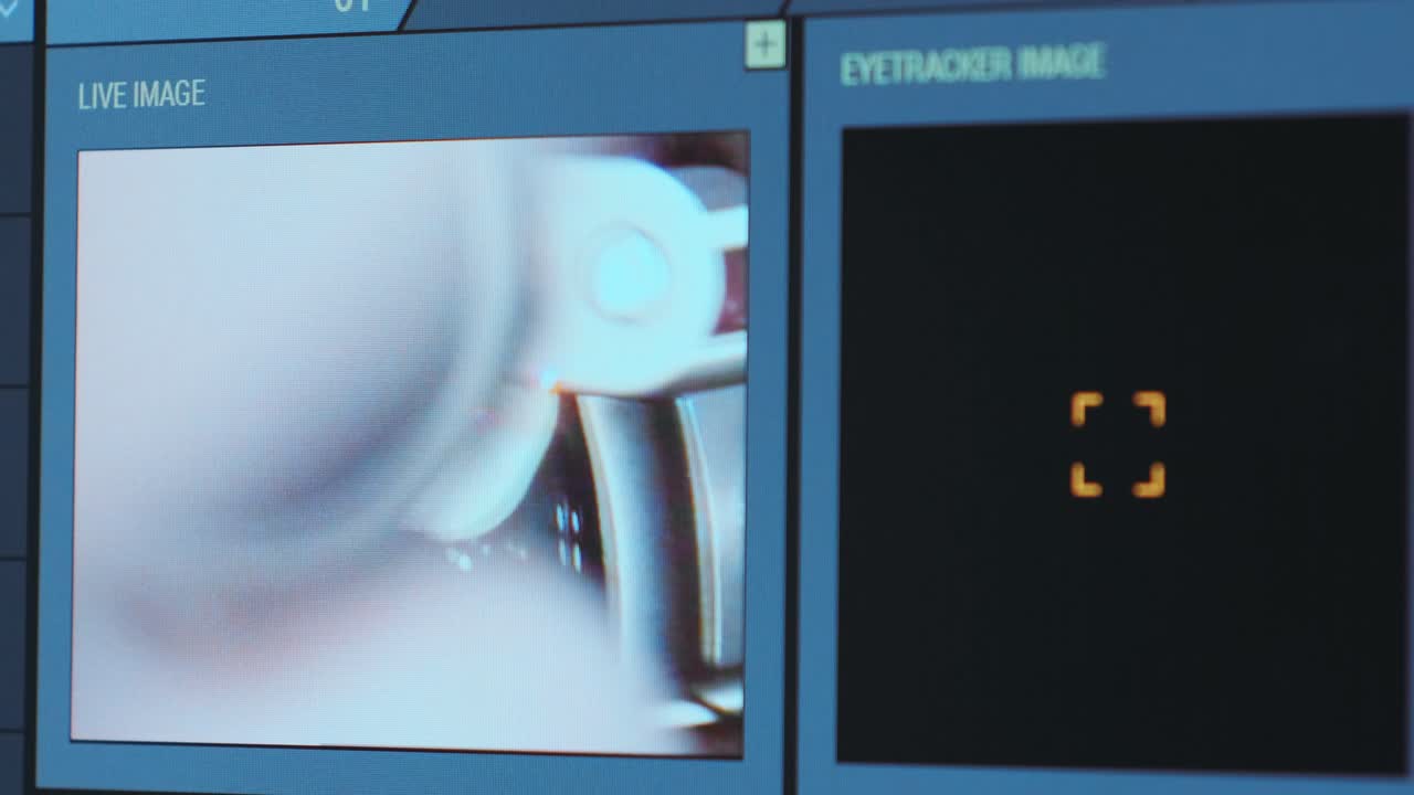 cirugía oftalmológica. vista en la pantalla del monitor médico en la sala de operaciones. lasik