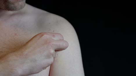 male removes final tape from healing chest scar after pectoralis tendon surgery. gently touches and inspects skin. dark background enhances detail