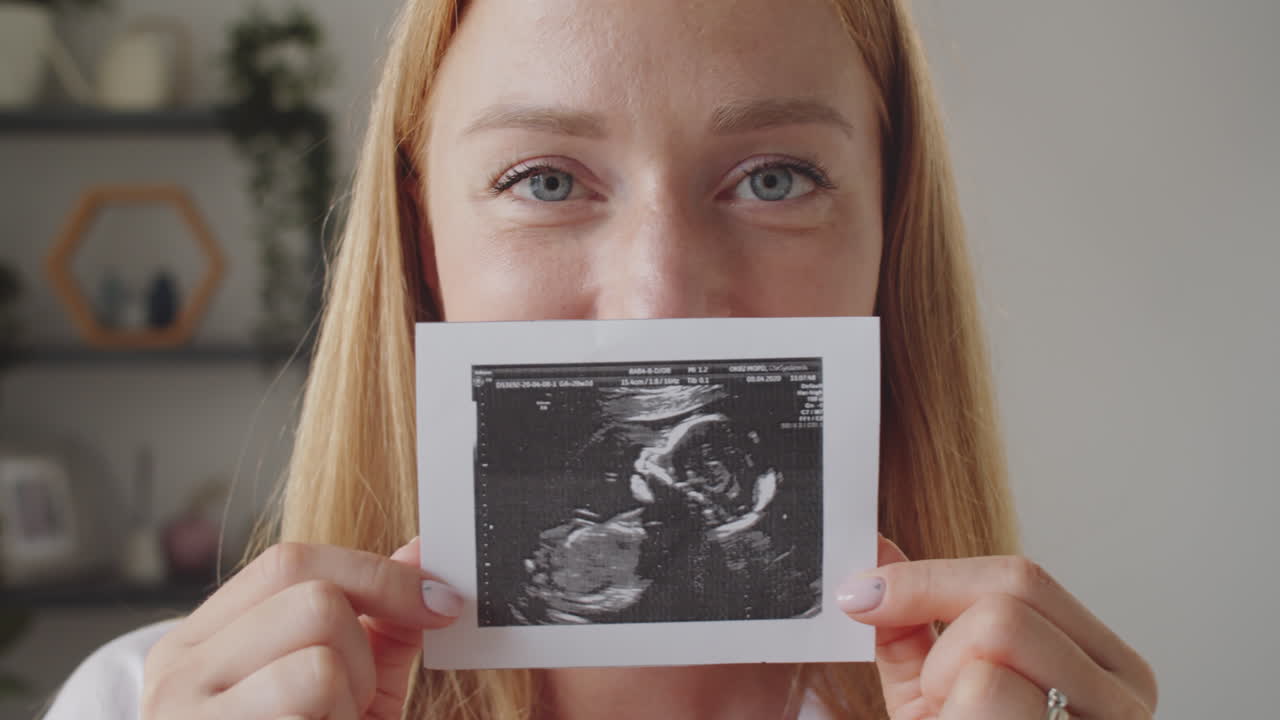 retrato de la madre embarazada con imagen de sonograma