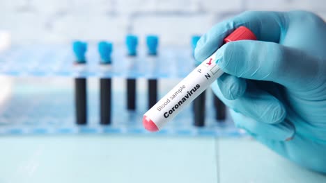 muestra de sangre para la prueba de coronavirus