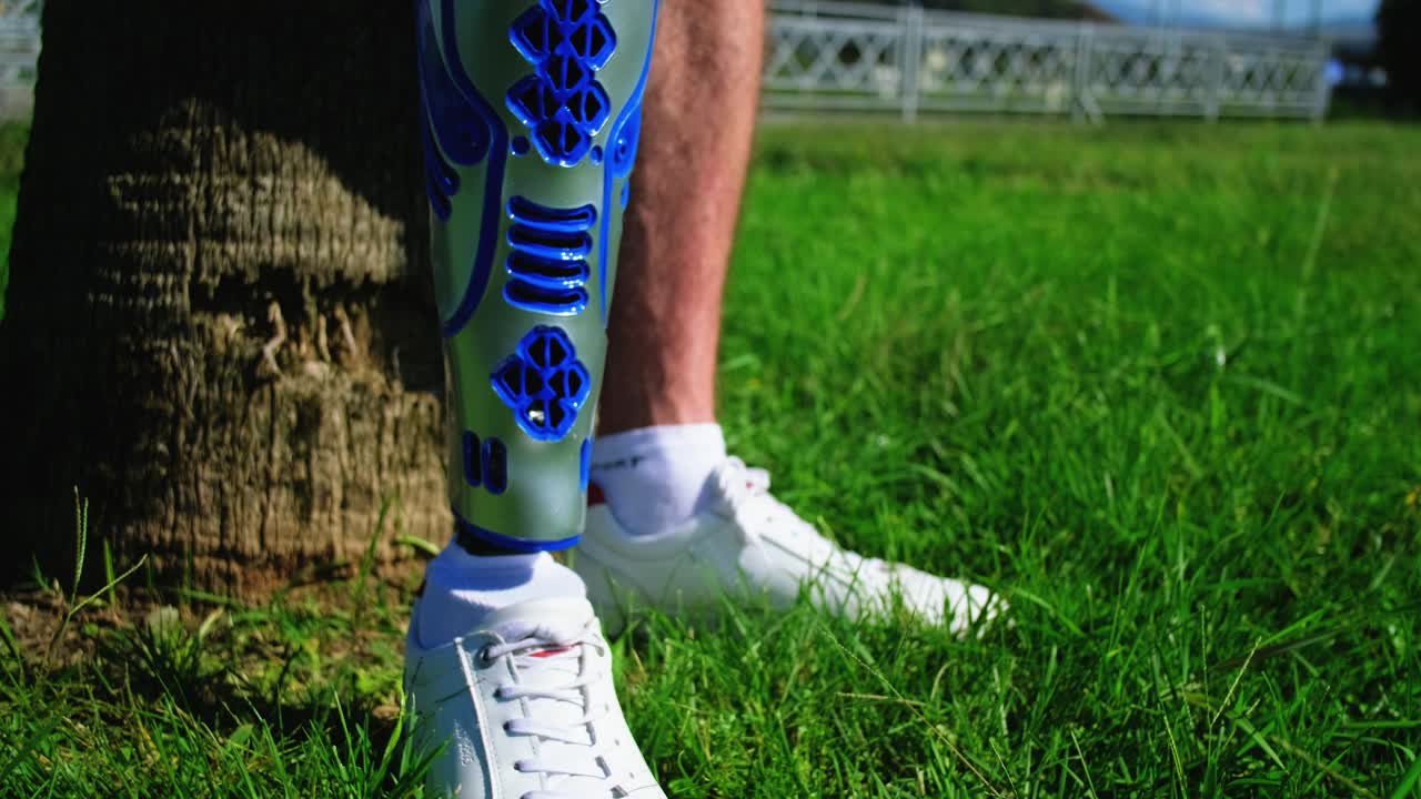 3d 프린터로 인공 다리를 만든 사람