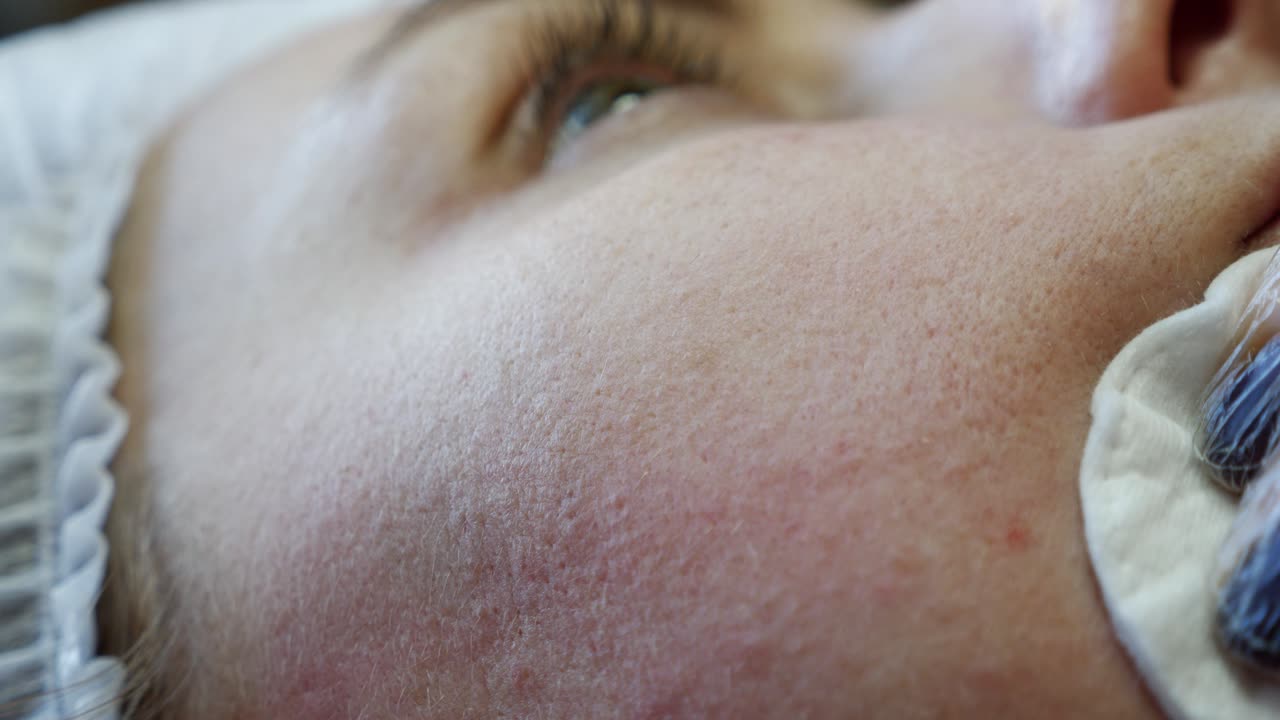 Cosmetic Facial Treatment