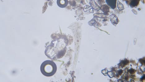 Diferentes-Especies-De-Agua-Dulce-De-Protozoos-Organismos-Unicelulares-Como-Estentores,-Ciliados-Y-Movimiento-De-Algas-Bajo-El-Microscopio-Vista-Archivada-Brillante