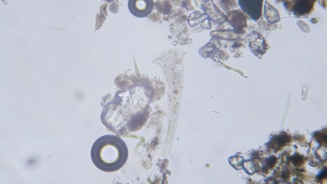 diferentes especies de agua dulce de protozoos organismos unicelulares como estentores, ciliados y movimiento de algas bajo el microscopio vista archivada brillante