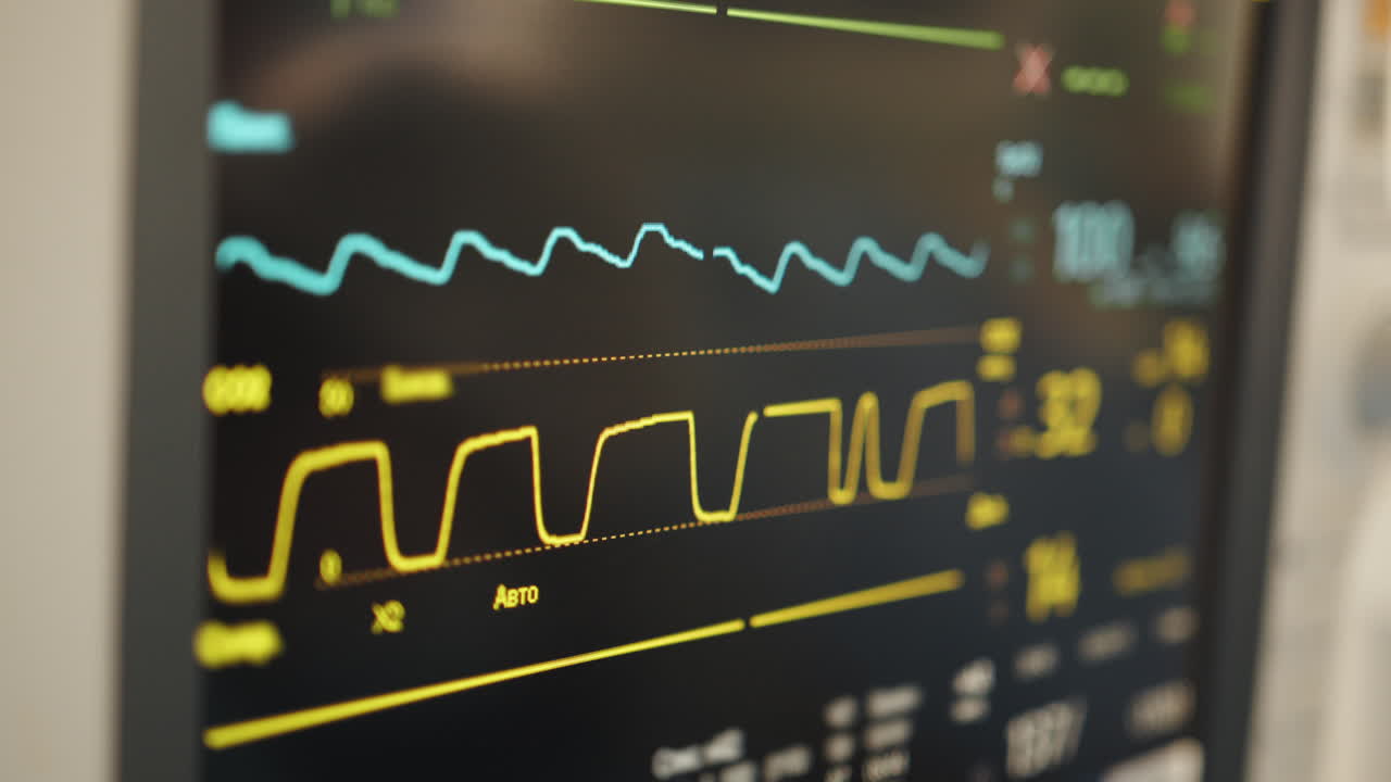 Medical Monitor Displaying Vital Signs