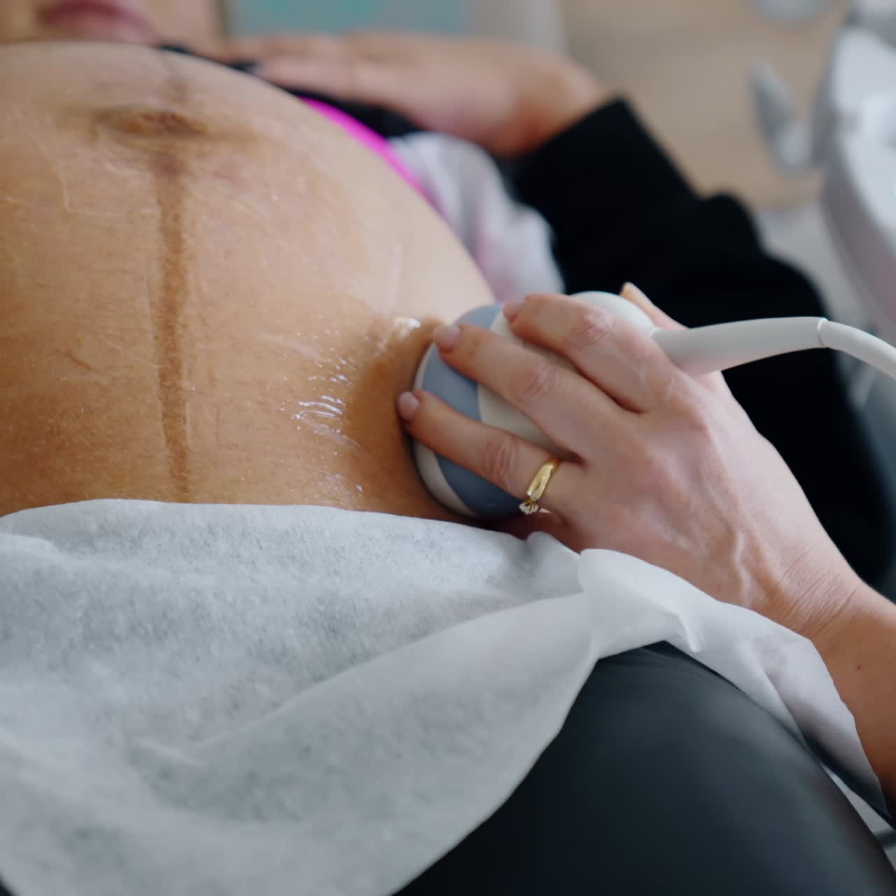 Pregnant woman is examined on the ultrasonic equipment. Medic holds the device on the big belly of a patient. Close up