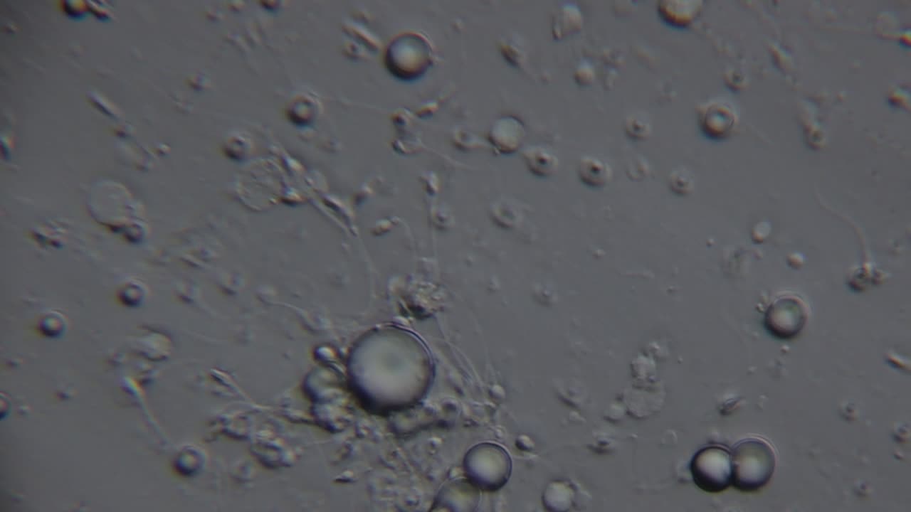 Microscopic view of spermatozoa, showing numerous round cells and a few with visible tails, moving in a fluid medium under magnification