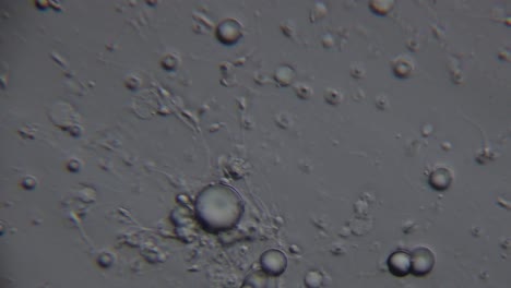 microscopic view of spermatozoa, showing numerous round cells and a few with visible tails, moving in a fluid medium under magnification
