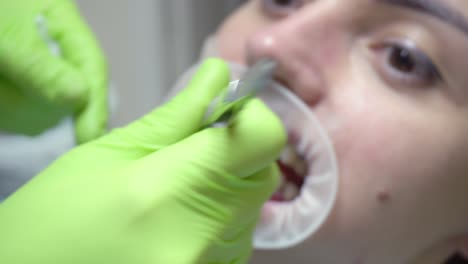 Removing-of-protective-whitening-gel-from-the-teeth.-Young-woman-with-an-expander-in-mouth-at-the-dental-clinic.-Modern-dental-office.-Shot-in-4k