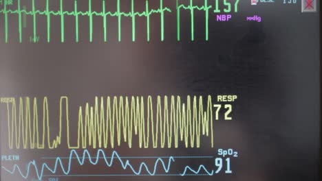 a hospital heart monitor monitor a baby inside of it's pregnant mother that is currently in labor