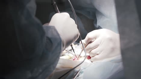 surgical procedure