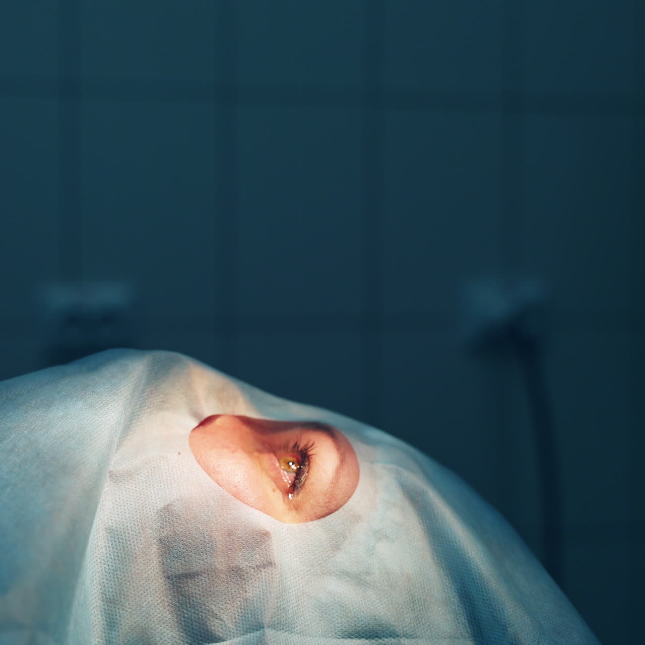 Ophthalmology operation. Surgeon's hands in gloves performing eye vision correction. Modern clinic and equipment. Selective video focus.