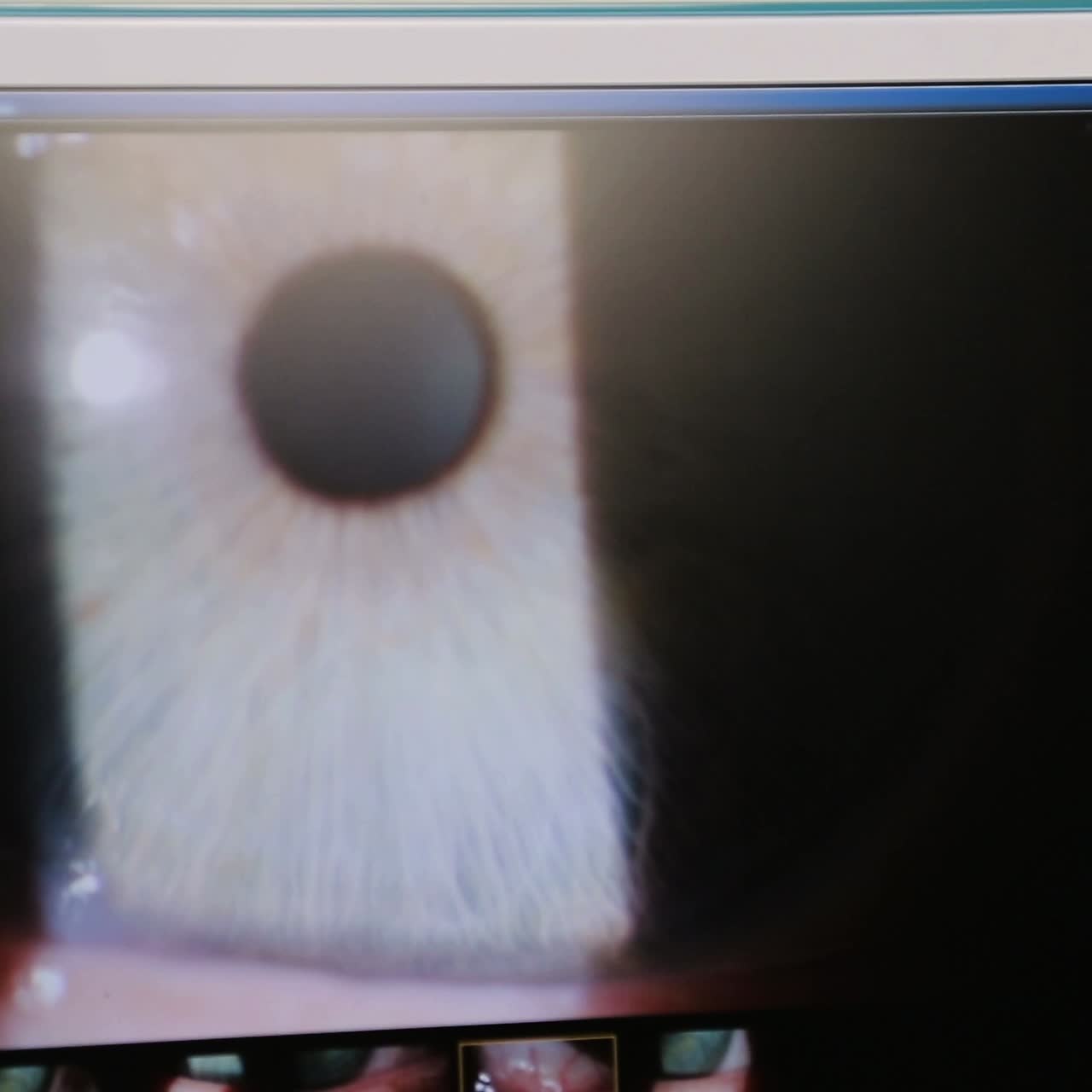 оптическое медицинское оборудование