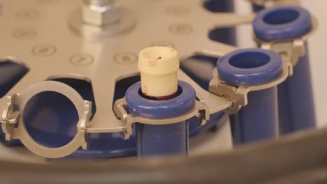 preparación de plasma rico en plaquetas. tubo con sangre en las manos. centrifugadora.