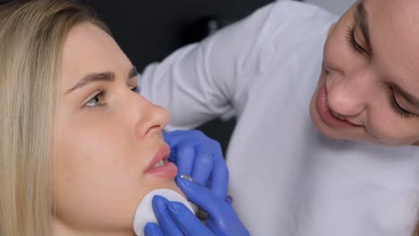 lip fillers procedure