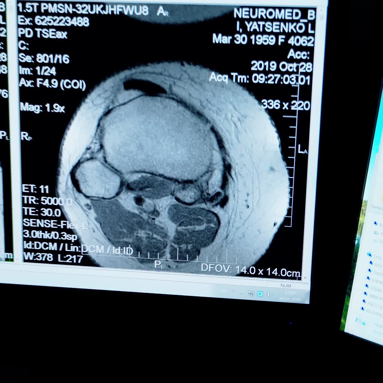 Doctor radiologist working at a computer with x-ray photos. Specialist is looking at scans of a patient's body on the screen of monitor on dark background.