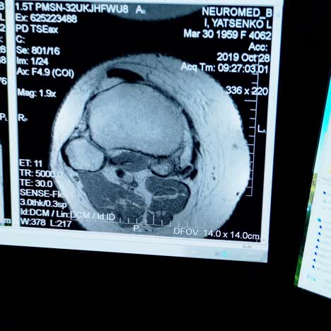 doctor radiologist working at a computer with x-ray photos. specialist is looking at scans of a patient's body on the screen of monitor on dark background.