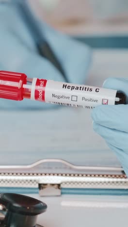 healthcare professional examines hepatitis c blood test tube in clinical setting