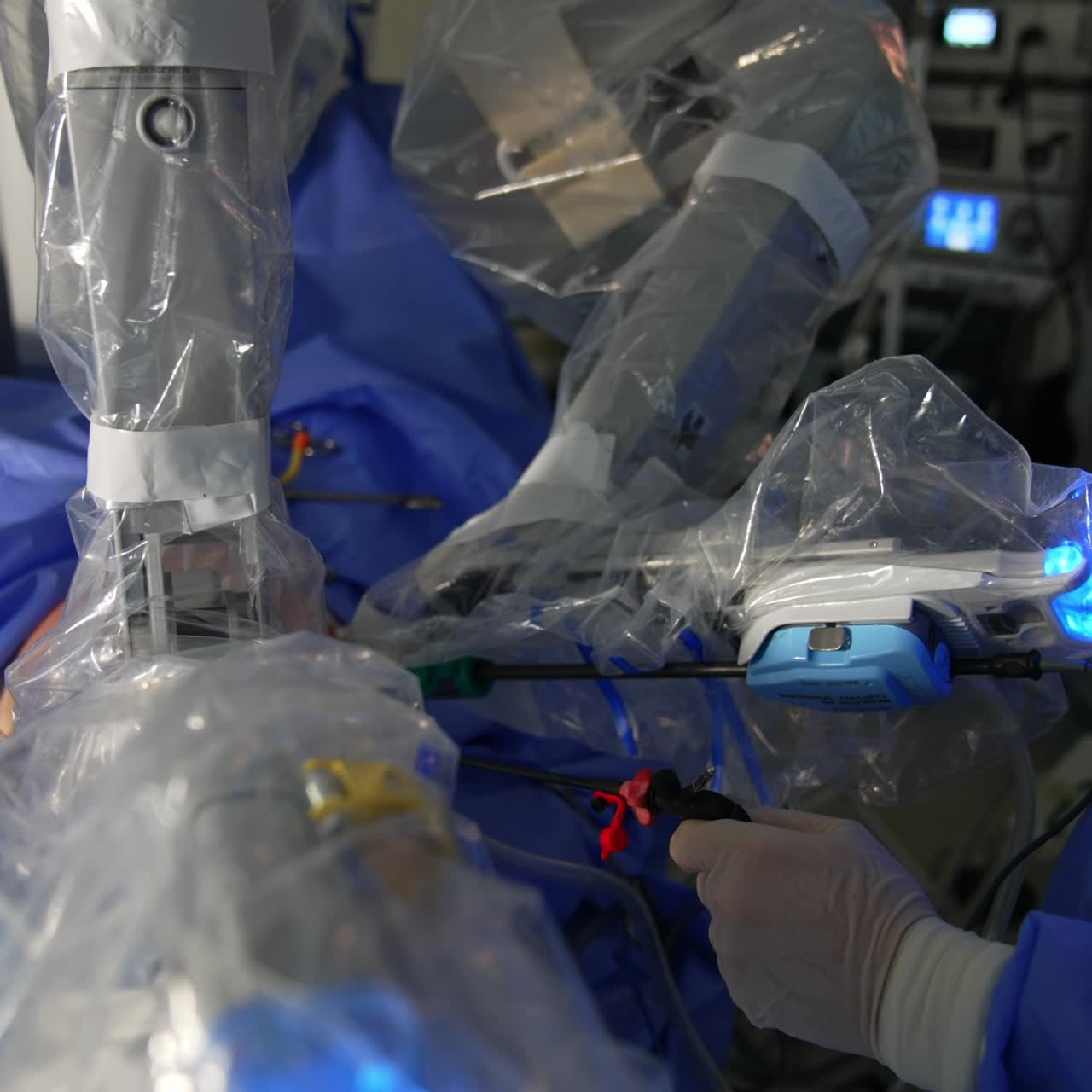 Robotic surgeon operating the patient. Equipment arms moving in the patient's body. Surgeon standing beside holds the instrument near robotic arms