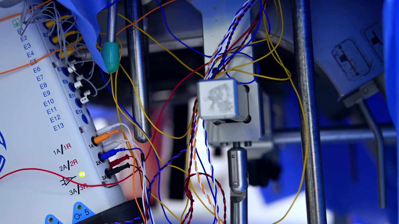 Attrezzatura medica avanzata per operazioni neurochirurgiche. Dispositivi collegati al tavolo operatorio nella sala chirurgica. Primo piano.