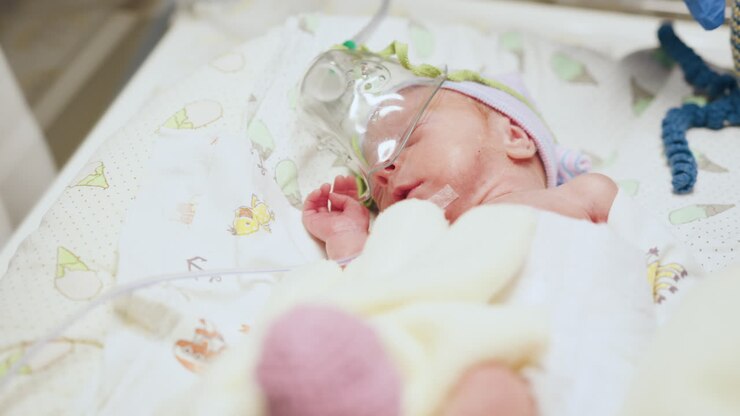 bambino prematuro in nicu