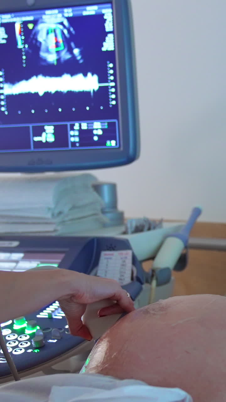 Ultrasound diagnostic for the pregnant woman. Lady wearing mask lies on the couch for ultrasonic examination. Vertical video