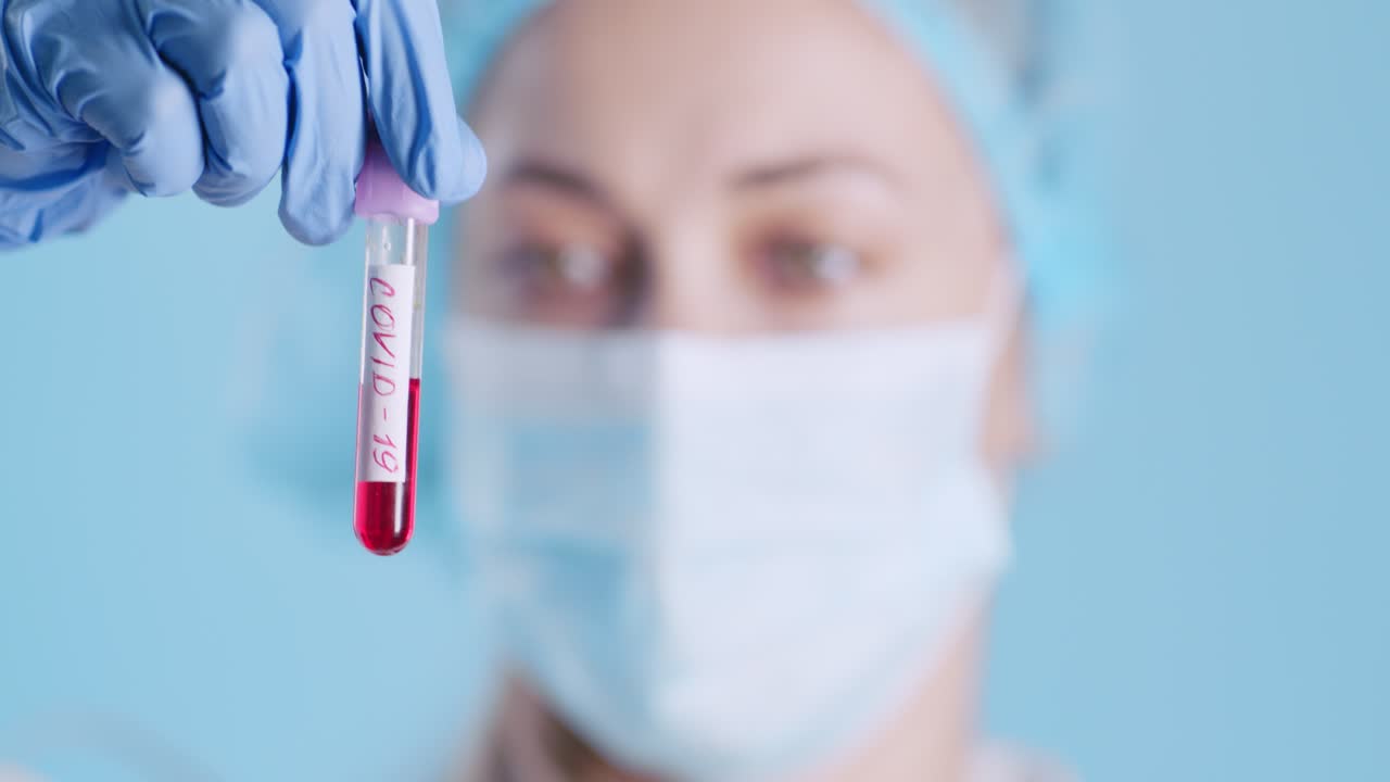 prueba de sangre para covid-19