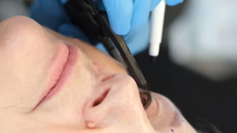 cosmetic procedure on a woman's face