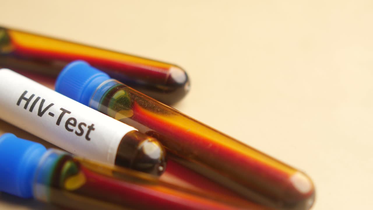 hiv 검사 혈액 플