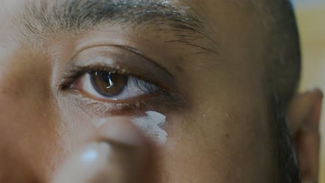 southeast asian indian man checking vitiligo around eyelid