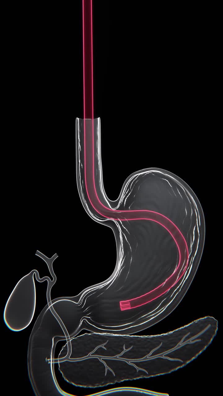 Xray Video of detailed medical illustration depicting a gastroscopy procedure used to visually examine the stomach | Gastroscopy Video in Vertical Format