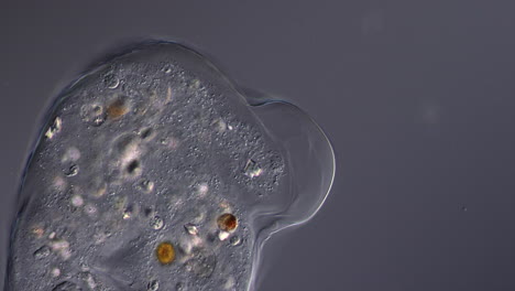microscopic view of a single-celled organism (amoeba)