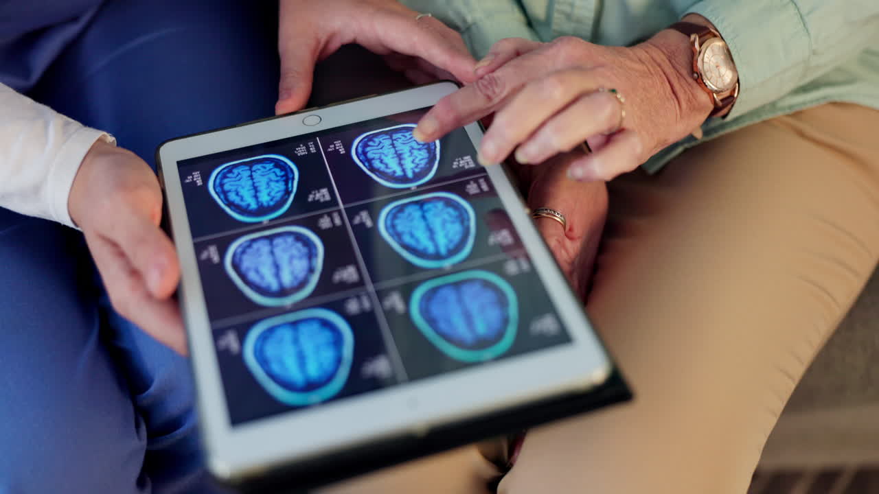 Medico che spiega i risultati della scansione cerebrale a un paziente anziano su tablet