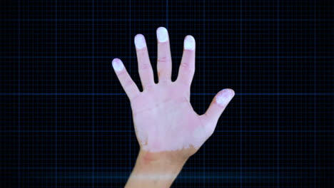 animación de una mano sometida a procedimientos de radiografía