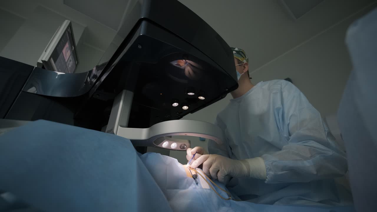 레이저 시력 교정: 안과 수술 중에 수술실에 있는 환자와 수술팀; 눈꺼풀 스럼; 라식 치료; 불임 개 아래의 환자