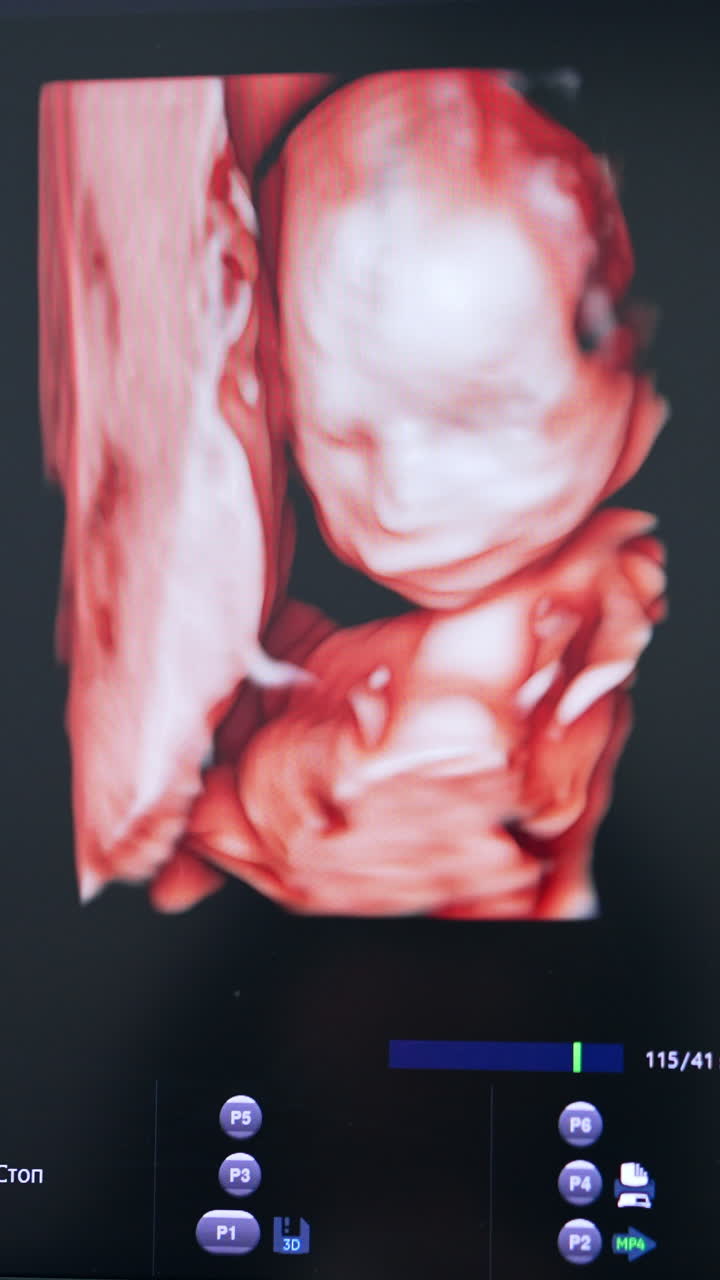 Immagine prenatale di un bambino nel grembo materno. Esame di un bambino non ancora nato sull'apparecchiatura ecografica. Primo piano. Video verticale.