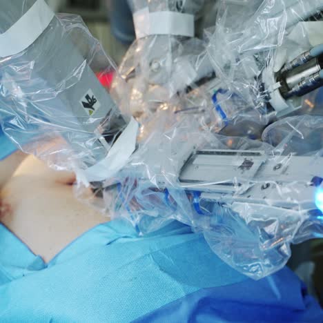 da vinci surgery system