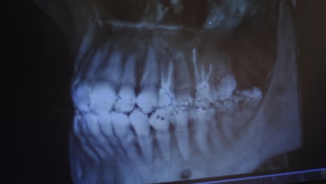 dental x-ray image