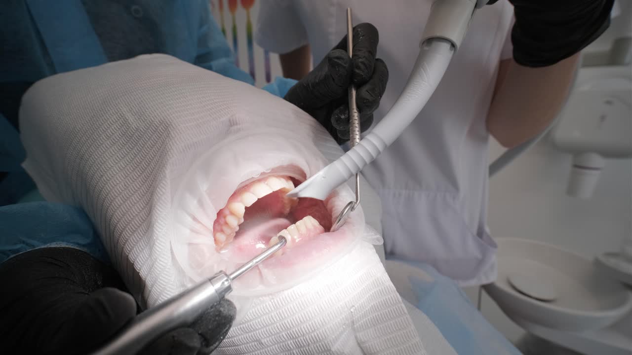 치아를 게 하는 제일 (gel) 이란 치아 게 만드는 제일 (gels) 이란 이빨을 게하는 제일 (whitening gel) 이란