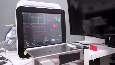 monitor de ritmo cardíaco con gráficos y números en el hospital